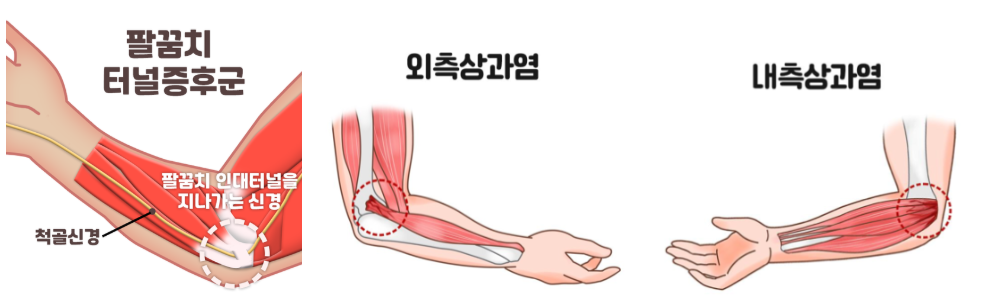 스크린샷 2025-11-04 140946.png